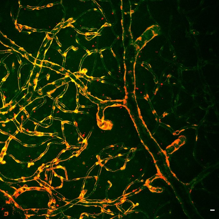 A hajszálerek működése: betekintés az élő agyba