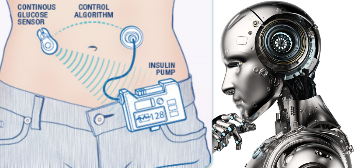 Hogyan gondolkodik a cukorbetegségről a mesterséges intelligencia?