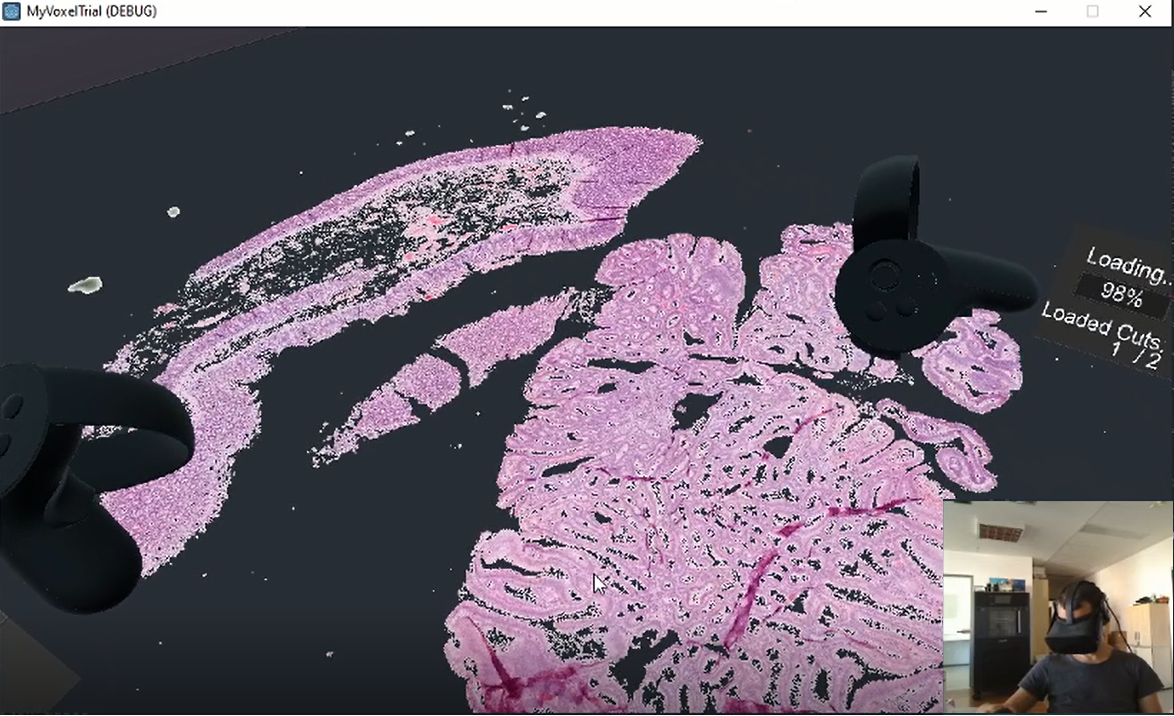 A digitális patológia VR -ban