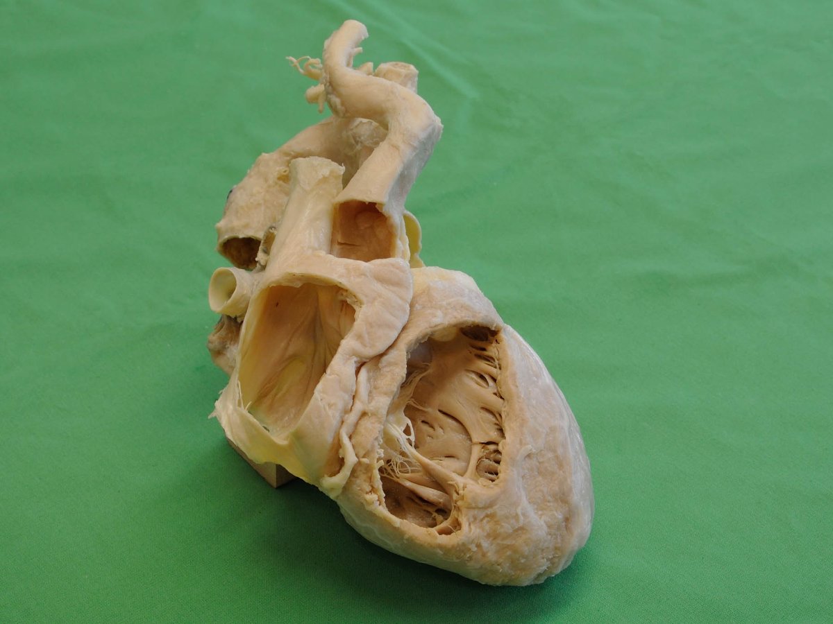 Utazás a koponyák körül, avagy anatómiai körséta