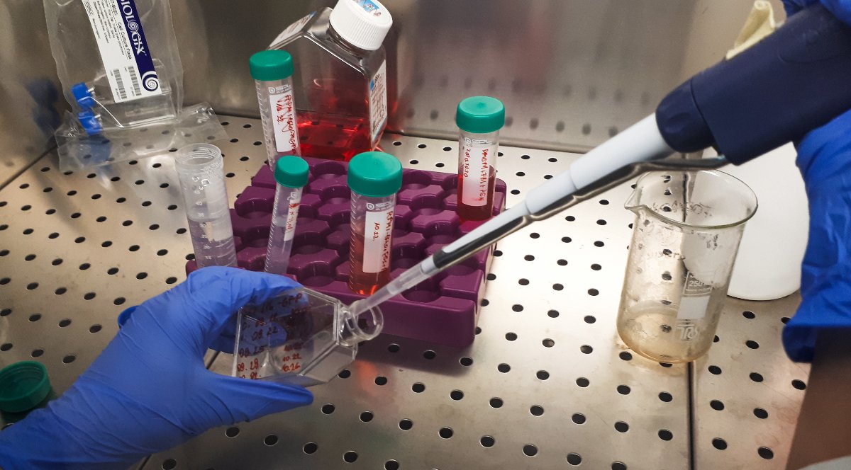 Rákdiagnosztikai kutatások a Pannon Egyetemen